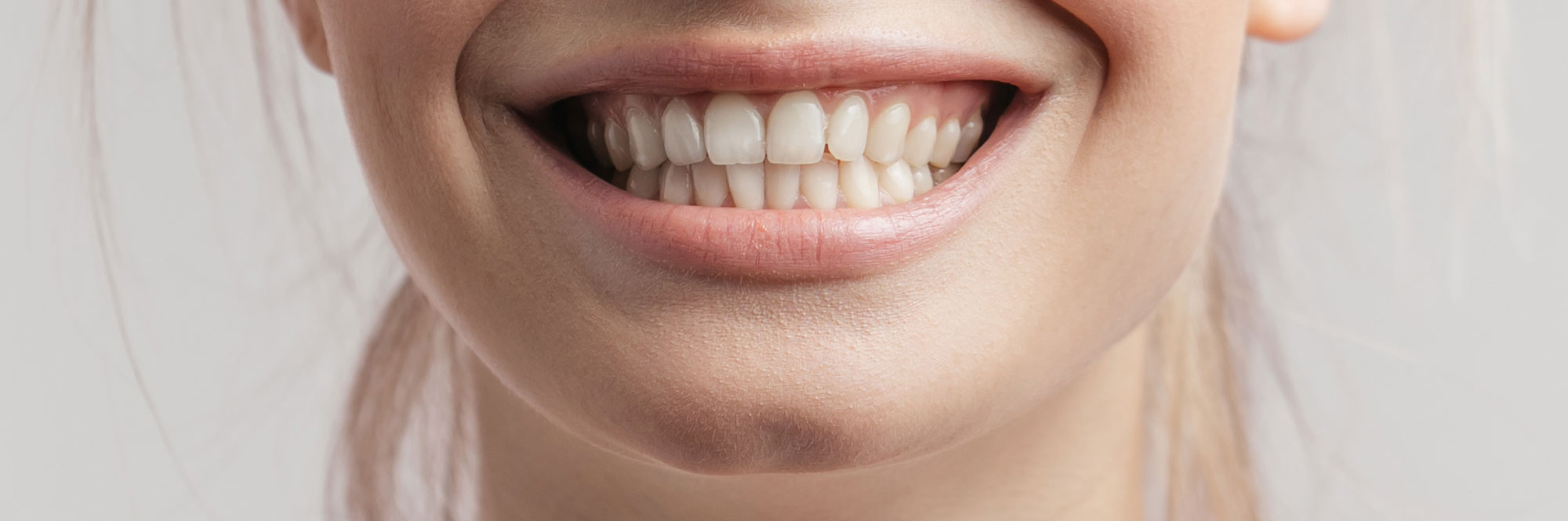 Cosmetic Dentistry Your Guide to Porcelain Veneers in NYC Dentist